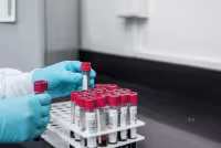 Vgt Stock: Enveric Biosciences jumps 158.79% on patent news