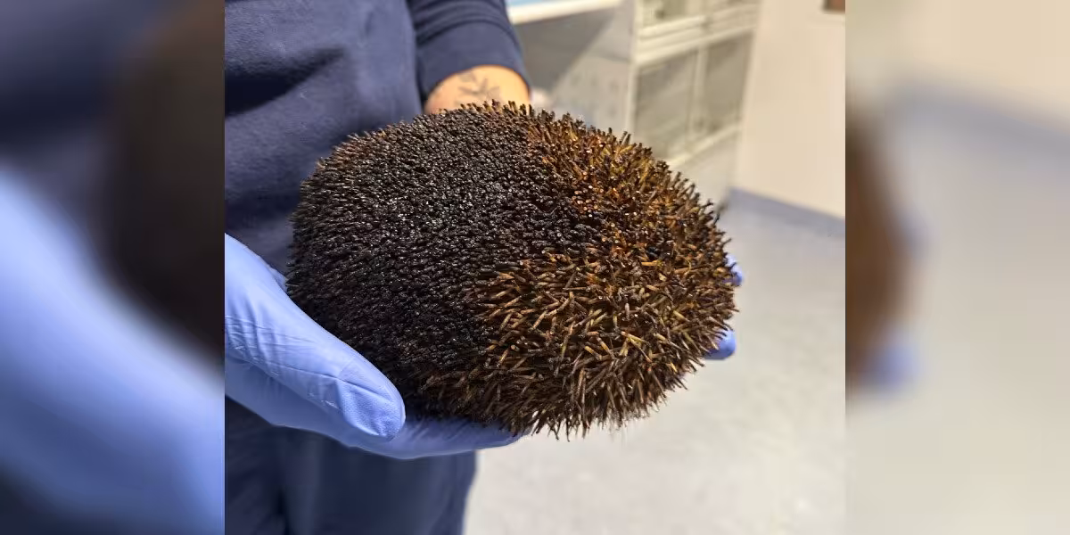 The Dodo: Burned in a Guy Fawkes bonfire, Bernard the hedgehog fights back