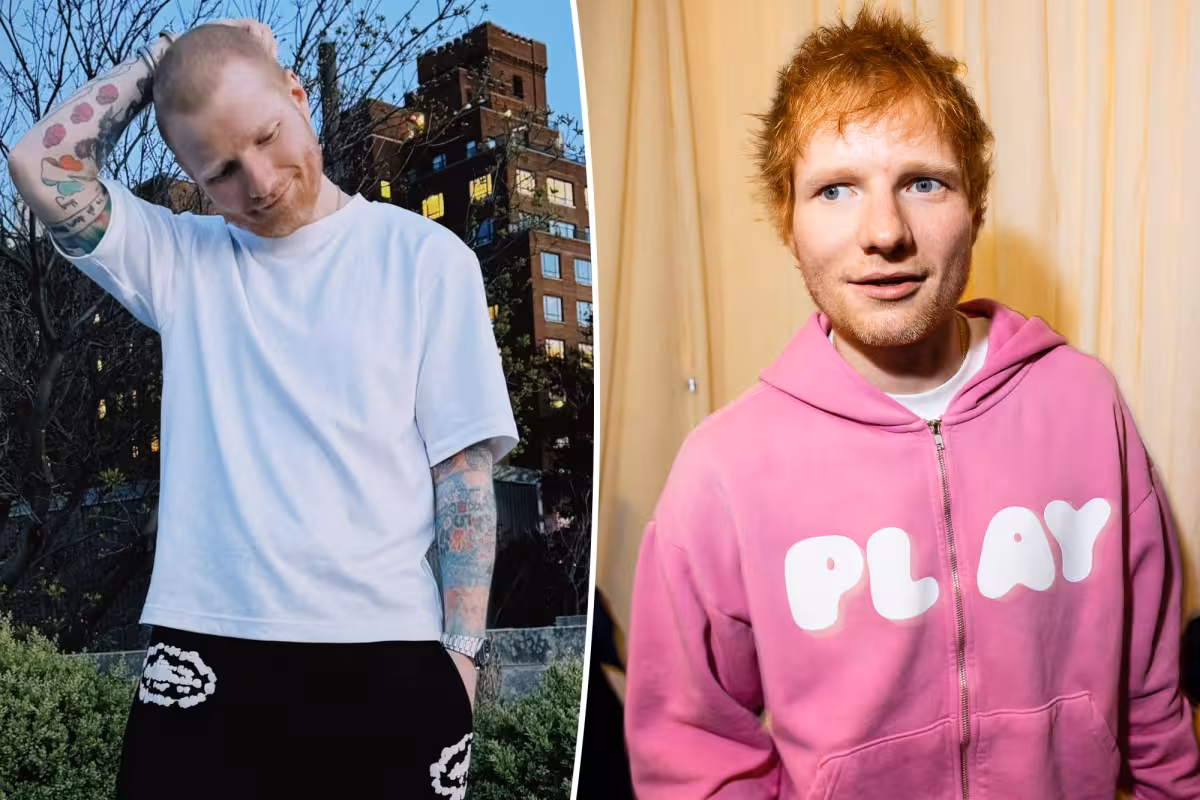 Ed Sheeran says shingles left him on the mend as he shaves head